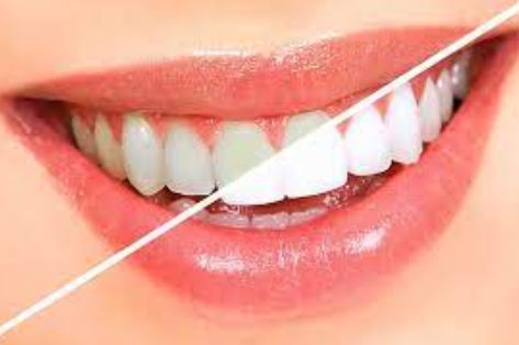  تجربتي مع أفضل أنواع معجون تبييض أسنان في العالم لإزالة الجير لتبييض الأسنان للمدخنين depurdent بالفحم من الصيدلية
